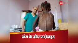 फिलिस्तीन नहीं, यूक्रेन नहीं, जंग झेल रहे इस मुस्लिम देश में कुपोषण का कहर