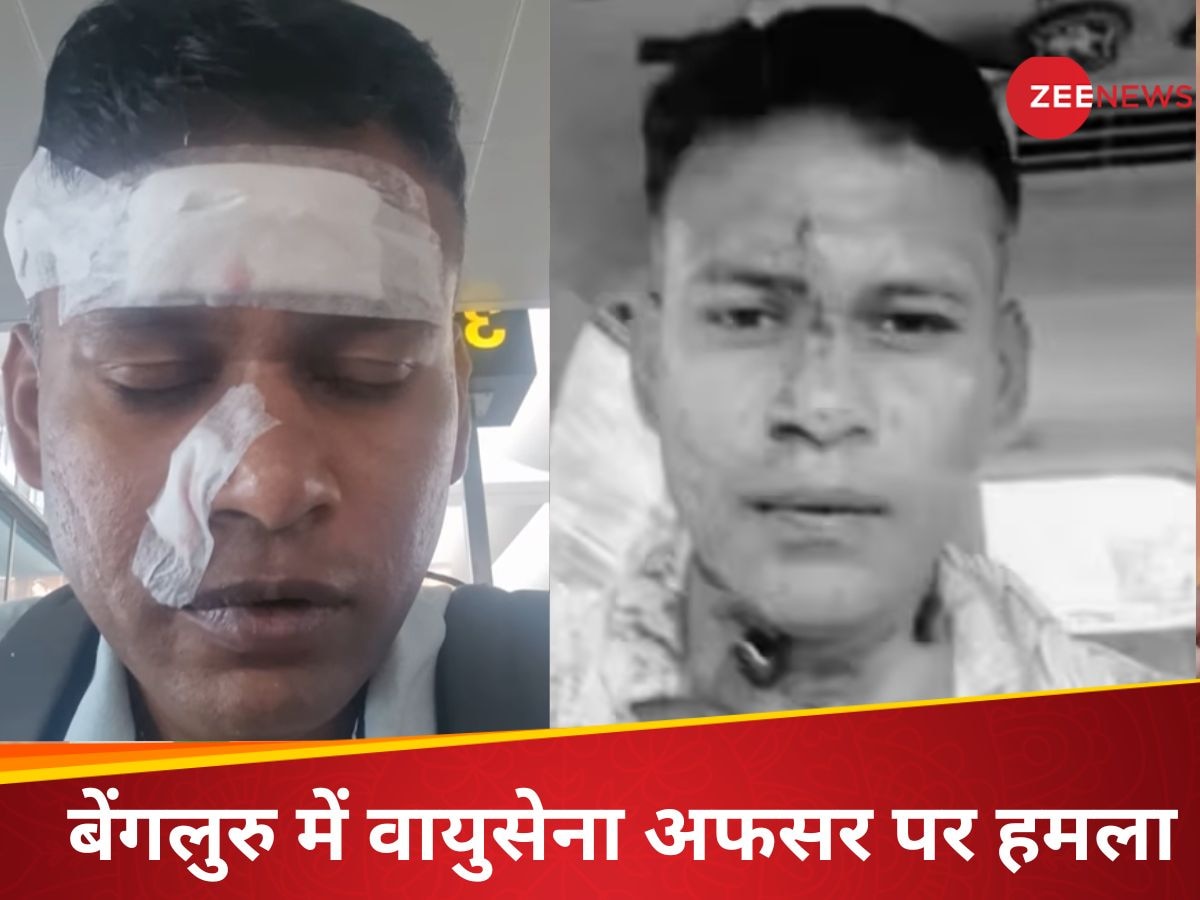 चेहरे-गर्दन पर चोटें, खून से लथपथ शरीर, बेंगलुरु में एयरफोर्स विंग कमांडर पर हमला; खुद सुनाई भयावह कहानी