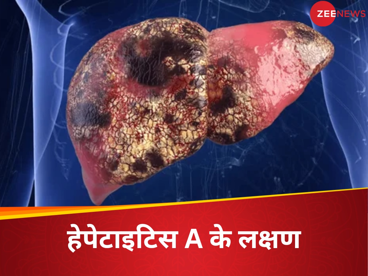 केरल में फैली लिवर की ये जानलेवा बीमारी, 16 लोगों की मौत, आप तो नहीं इन लक्षणों को कर रहे इग्नोर