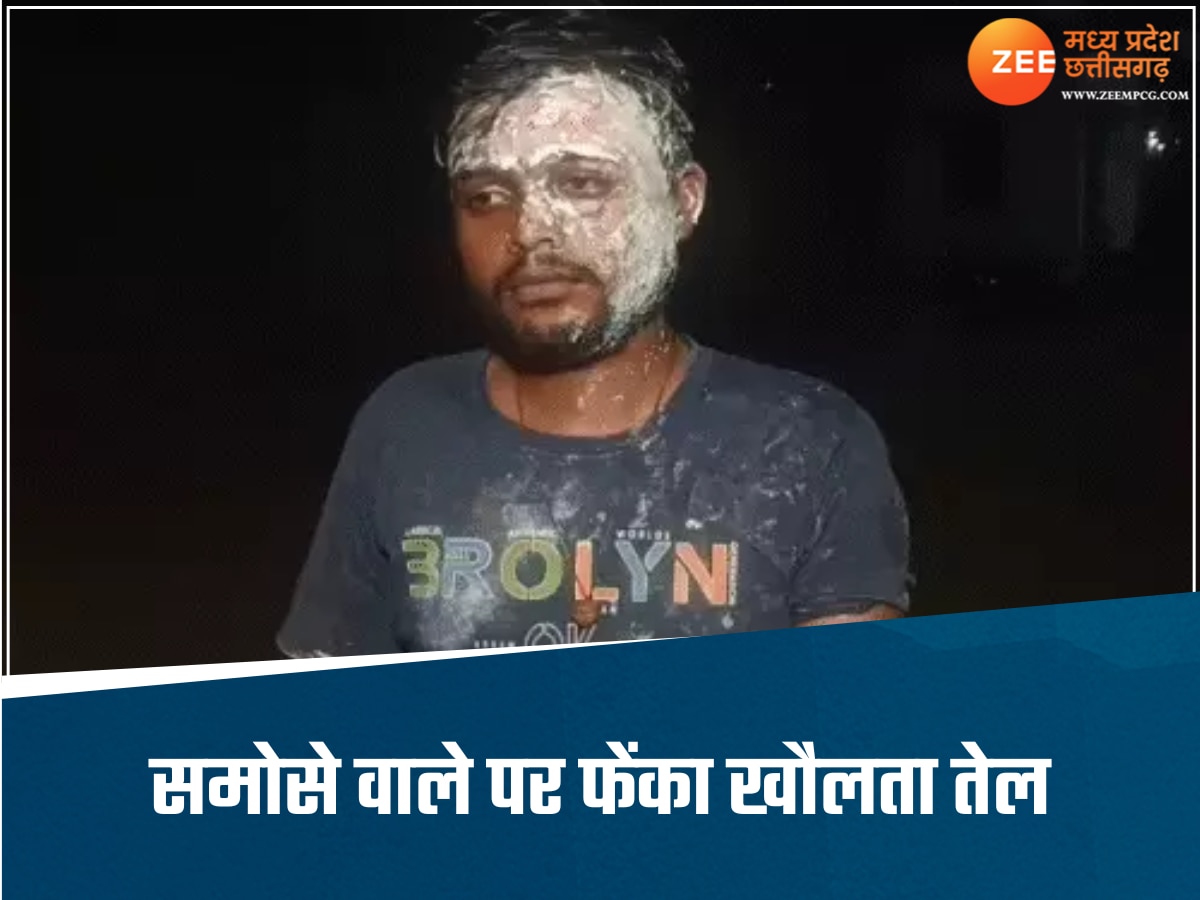 समोसे में हुई देरी तो भड़क गया ग्राहक, इमरान ने गुस्से में दुकानदार पर फेंका खौलता तेल, बुरी तरह झुलसा 