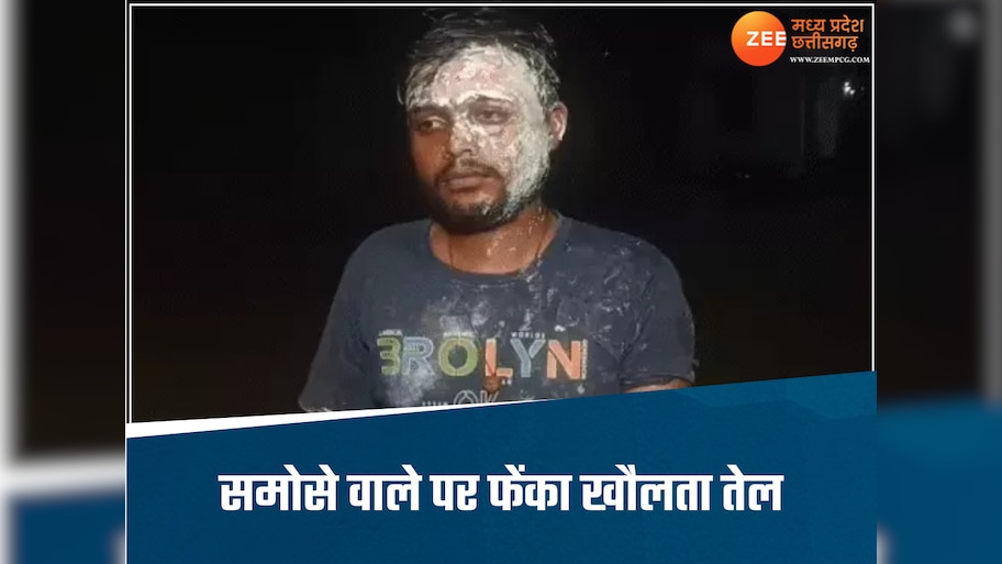 समोसे में हुई देरी तो भड़क गया ग्राहक, इमरान ने गुस्से में दुकानदार पर फेंका खौलता तेल, बुरी तरह झुलसा 