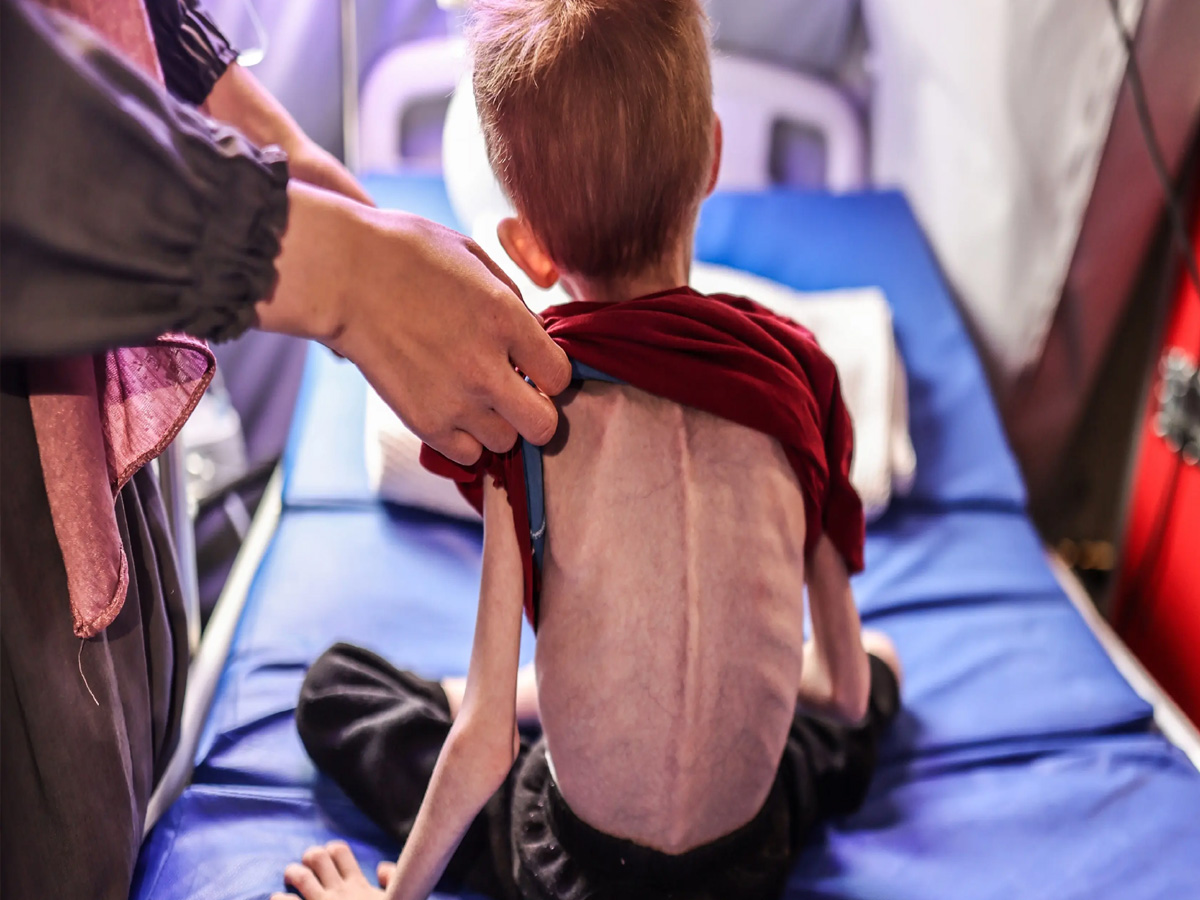 Gaza में भूख से मर रहे हैं बच्चे, यूएन बोला खाना बिल्कुल हुआ खत्म Gaza में भूख से मर रहे हैं बच्चे, यूएन बोला खाना बिल्कुल हुआ खत्म