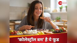 आपका पसंदीदा फूड है दिल का दुश्मन, कार्डियोलॉजिस्ट ने इसे बताया 'कोलेस्ट्रॉल बम'