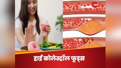 बॉडी में 'कोलेस्ट्रॉल की फैक्ट्री' खुल जाएगी, अगर खाना नहीं छोड़ेंगे 4 चीजें