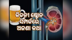 Kidney Stones: ବିୟର ପିଇଲେ ଭଲ ହୁଏ କି କିଡନୀ ଷ୍ଟୋନ ? ଜାଣନ୍ତୁ ଡାକ୍ତରଙ୍କ ମତ