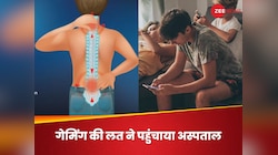 डेली 12 घंटे मोबाइल गेम खेलता था लड़का, रीढ़ की हड्डी की बज गई बैंड