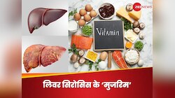 किस विटामिन की कमी से हो सकता है लिवर सिरोसिस? एक नहीं 3 हैं 'गुनहगार'