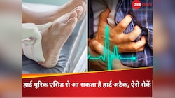 हाई यूरिक एसिड कमजोर कर रहा दिल, अचानक आ सकता है हार्ट अटैक, ऐसे करें कंट्रोल