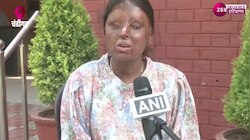 Chandigarh Topper Kaifi : एसिड अटैक पीड़िता खुद देख नहीं सकती पर दिखाई हर स्टूडेंट को राह