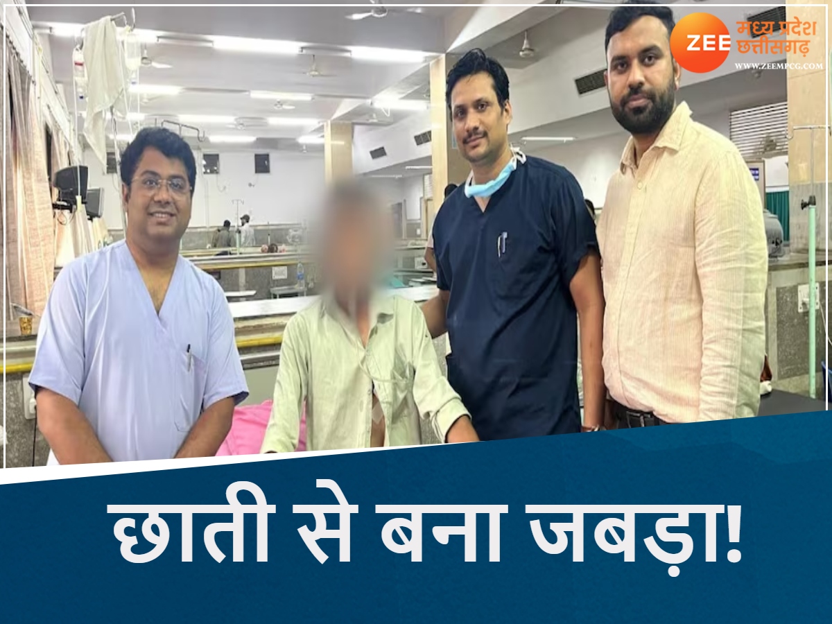 MP के BMHRC में जबड़े के कैंसर की जटिल सर्जरी, छाती से जबड़ा बनाकर बचाई जान, इस कार्ड से फ्री इलाज MP के BMHRC में जबड़े के कैंसर की जटिल सर्जरी, छाती से जबड़ा बनाकर बचाई जान, इस कार्ड से फ्री इलाज