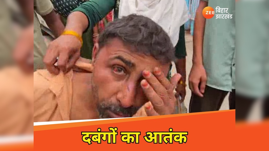 Begusarai News: खूब दबाकर खाया मीट! जब दुकानदार ने मांगे पैसे तो हाथ-पैर बांधकर पीटा