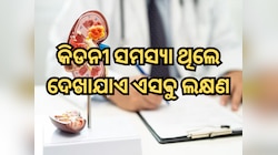 କିଡନୀ ସମ୍ବନ୍ଧୀୟ ସମସ୍ୟା ଥିଲେ ଆରମ୍ଭରୁ ଦେଖାଯାଏ ଏହି ସବୁ ଲକ୍ଷଣ, କରନ୍ତୁ ନାହିଁ ଅଣଦେଖା