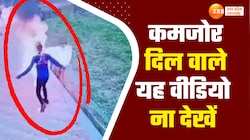 सुनो! मुझ से शादी कर लो वरना... इनकार पर युवक ने प्रेमिका के सामने खुद को लगाई आग