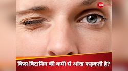 आंख फड़कना शुभ-अशुभ नहीं, इस एक विटामिन की कमी का है संकेत; इग्नोर करना पड़ेगा महंगा