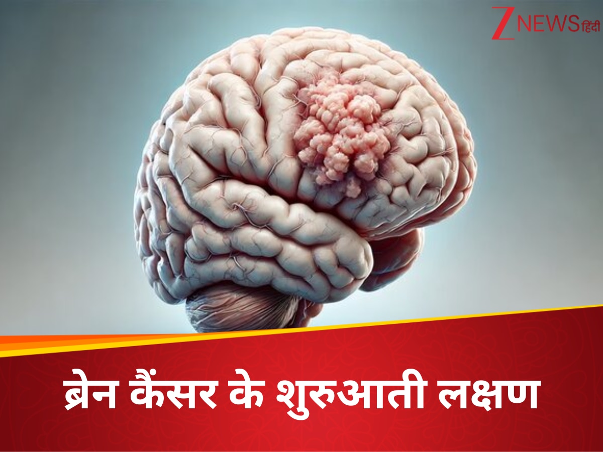 न्यूरोलॉजिस्ट ने इन 5 लक्षणों को लेकर दी चेतावनी, पहचाने में देरी ब्रेन ट्यूमर को बना सकती है जानलेवा
