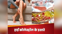 शरीर के ये 3 हिस्‍से अगर दर्द से हो जाएं चूर, तो समझ जाएं कि बढ़ चुका है कोलेस्ट्रॉल