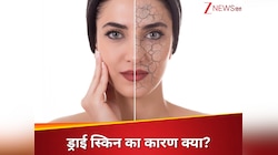 किस विटामिन की कमी से स्किन होने लगती है ड्राई? तुरंत खाना शुरू करें ये 5 फूड