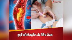 कोलेस्ट्रॉल का कच्चा चिट्ठा खोलकर रख देगा ये एक टेस्ट, दिल की सेहत का भी लगेगा पता