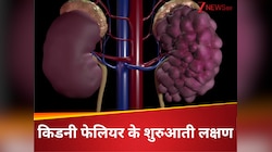 दम तोड़ते किडनी के 6 लक्षण, कहीं आप तो नहीं कर रहे चुपचाप बर्दाश्त, अभी करें चेक