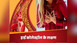 हाई कोलेस्ट्रॉल के 4 इशारे चिल्ला-चिल्लाकर करते हैं अलर्ट, हार्ट अटैक आ चुका है करीब