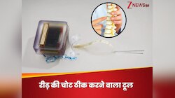 रीढ़ की हड्डी की चोट भी होगी ठीक, साइंटिस्ट ने बनाई अनोखी डिवाइस, नहीं रहेंगे अपाहिज