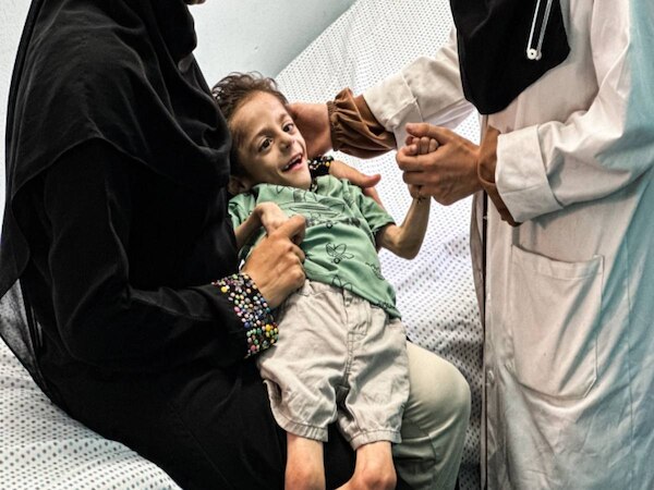 Gaza: दूध पीने वाले बच्चों को पिलाया जा रहा दाल का पानी, बुरे हालात में गाजा