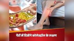  पैरों में नजर आएंगे हाई कोलेस्ट्रॉल के 5 लक्षण, अजीब सा दिखे तो तुरंत कराएं टेस्ट
