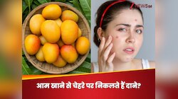 काटकर , या चूसकर, आम खाएं तो सताता है चेहरे में दाने निकलने का डर, आखिर क्या है सच?