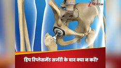 हिप रिप्लेसमेंट सर्जरी कराई है, तो कुछ वक्त के लिए इन 3 एक्टिविटीज पर लगा लें ब्रेक