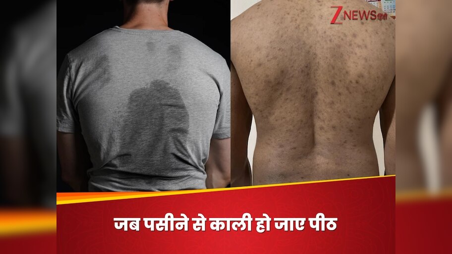 Due to these carelessnesses black Dark spots of sweat start forming on ...
