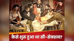 जब सुअर सर्जन ने बचाई थी पत्नी की जान, फिर बना सिजेरियन डिलीवरी का जनक! जानें