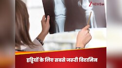 Gen Z की हड्डियां हो सकती हैं बुजुर्गों जैसी कमजोर, अगर होगी इस विटामिन की कमी