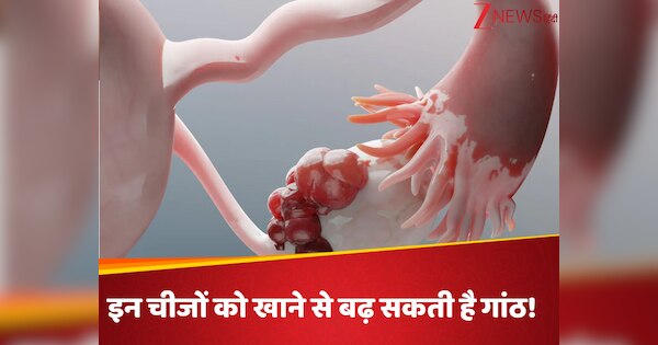 What to Avoid in Rasoli or Uterus Cysts | बच्चेदानी में गांठ होने पर ...