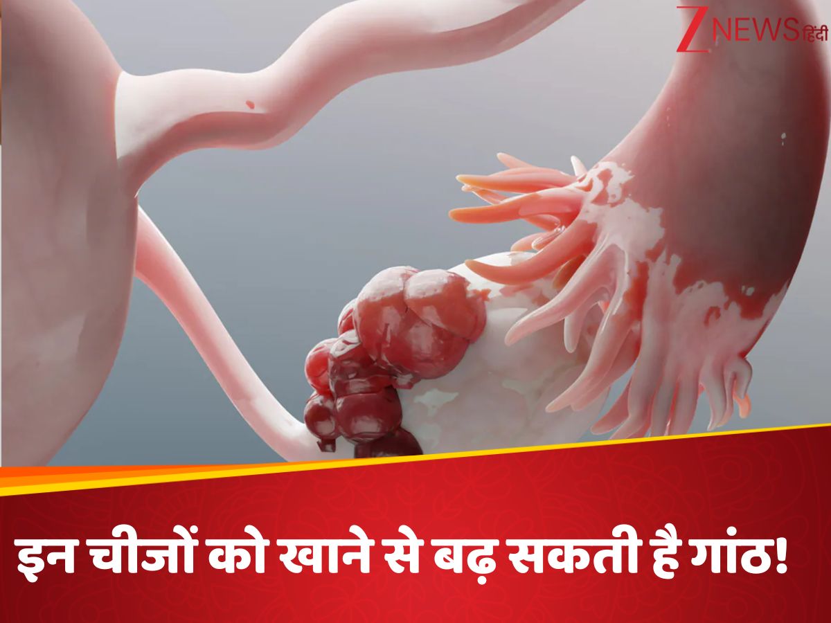 Bladder Rasoli What to Avoid in Rasoli or Uterus Cysts | बच्चेदानी में गांठ होने पर ...