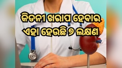 କିଡନୀ ଖରାପ ହେବାର ଏହା ହେଉଛି ଗୁପ୍ତ ଲକ୍ଷଣ! ଶରୀରରେ ନଜର ଆସିଲେ ତୁରନ୍ତ କରନ୍ତୁ ଚେକଅପ୍