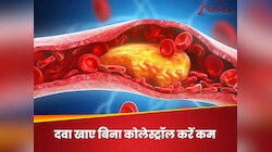दिल के दुश्मन कोलेस्ट्रॉल को निचोड़कर बाहर निकालना है, पर दवा नहीं खानी, करें 5 काम