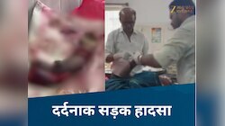 अनुपपूर में रूह कंपा देने वाला एक्सीडेंट, महिला का बायां हाथ कटकर हुआ अलग
