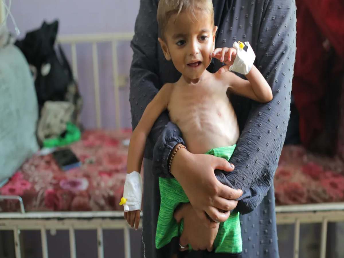 UN ने Gaza में अकाल का किया ऐलान, 5 लाख लोगों पर भूख का संकट UN ने Gaza में अकाल का किया ऐलान, 5 लाख लोगों पर भूख का संकट