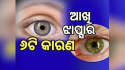 Eye damage: ବେଳେବେଳେ ଆଖିକୁ ଦେଖାଯାଉଛି କି ଝାପସା ? ତେବେ କରନ୍ତୁନି ଏହି ଭୁଲ୍...