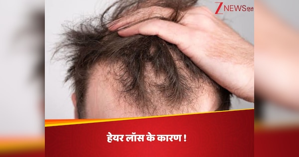 hair dryer to Using too much shampoo these mistakes can cause hair loss ...