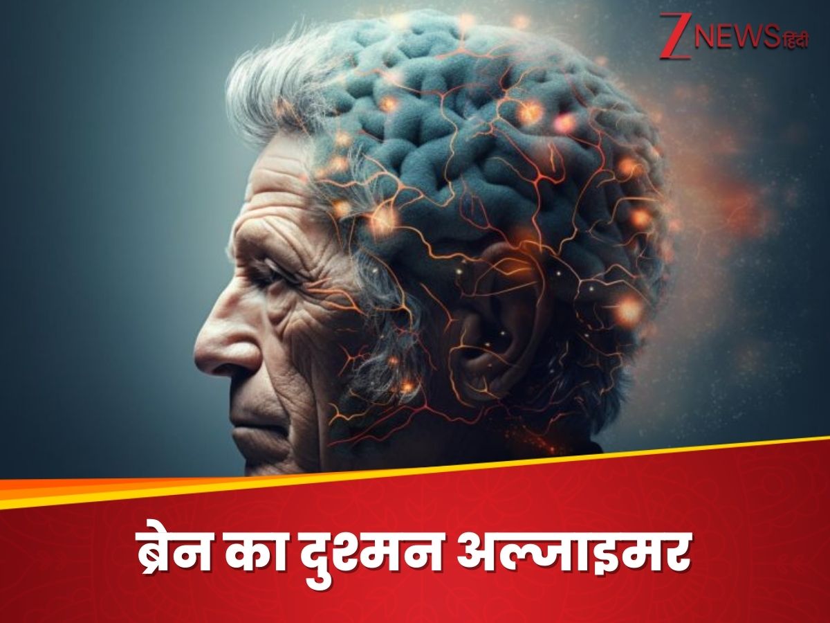 ब्रेन का कैसे अफेक्ट करता है अल्जाइमर? बुजुर्गों की जिंदगी बना देता है नर्क ब्रेन का कैसे अफेक्ट करता है अल्जाइमर? बुजुर्गों की जिंदगी बना देता है नर्क