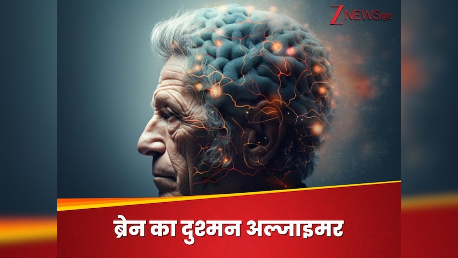 ब्रेन का कैसे अफेक्ट करता है अल्जाइमर? बुजुर्गों की जिंदगी बना देता है नर्क