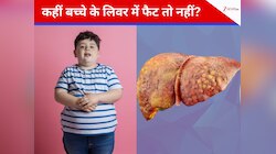 बॉडी वेट ही नहीं, लिवर फैट भी देखें, ऐसे लगाएं मोटे बच्चों के लिए खतरे का अंदाजा