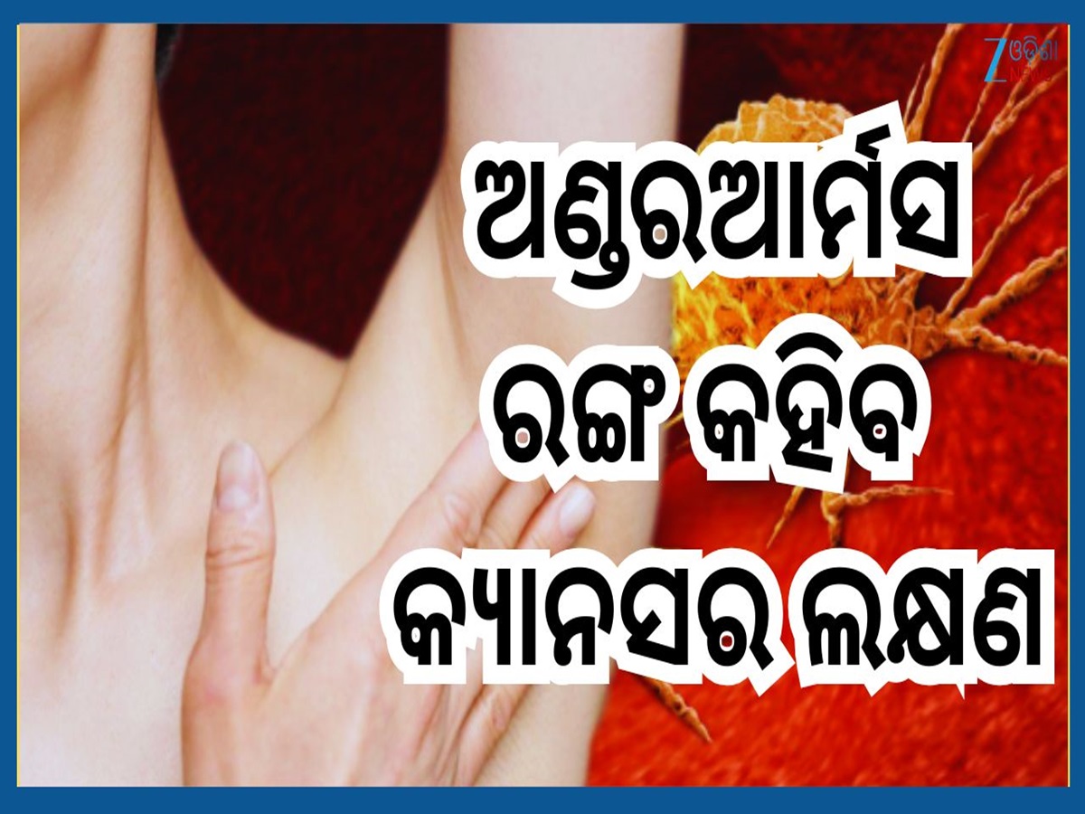 Cancer Symptoms: କାଖ ତଳେ ଦେଖାଦିଏ କ୍ୟାନସରର ଏହି ୫ ଲକ୍ଷଣ...କରନ୍ତୁନି ଅଣଦେଖା Cancer Symptoms: କାଖ ତଳେ ଦେଖାଦିଏ କ୍ୟାନସରର ଏହି ୫ ଲକ୍ଷଣ...କରନ୍ତୁନି ଅଣଦେଖା