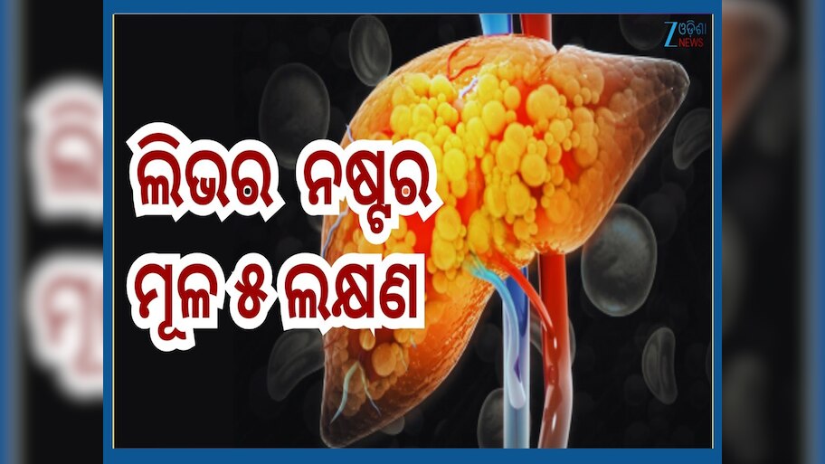 Signs of Fatty Liver: ଫ୍ୟାଟି ଲିଭରର ଏହି ୫ ପ୍ରାରମ୍ଭିକ ଲକ୍ଷଣ, ଦେଖାଦେଉଥିଲେ ଶୀଘ୍ର କରନ୍ତୁ ଚିକିତ୍ସା