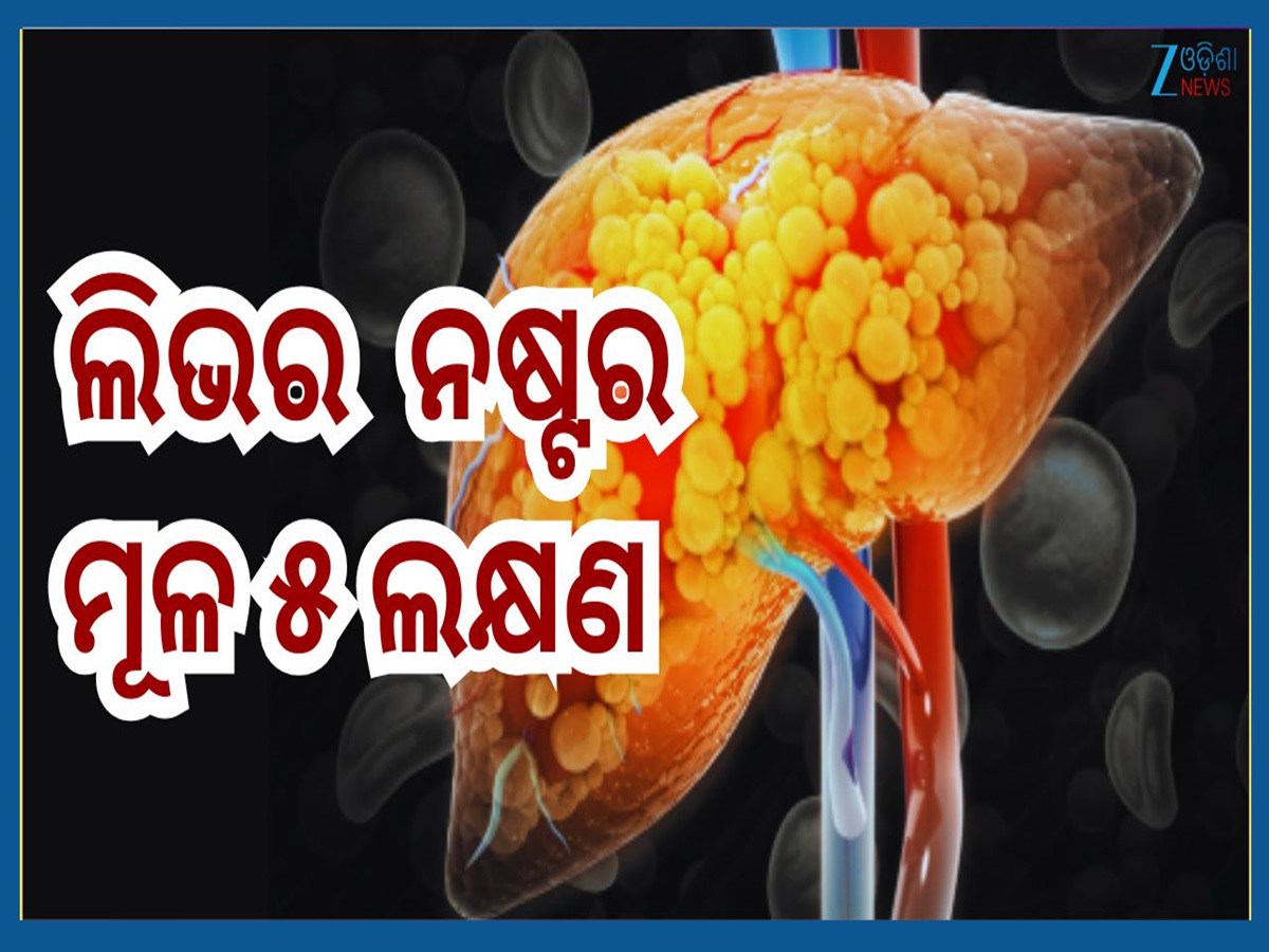 Signs of Fatty Liver: ଫ୍ୟାଟି ଲିଭରର ଏହି ୫ ପ୍ରାରମ୍ଭିକ ଲକ୍ଷଣ, ଦେଖାଦେଉଥିଲେ ଶୀଘ୍ର କରନ୍ତୁ ଚିକିତ୍ସା Signs of Fatty Liver: ଫ୍ୟାଟି ଲିଭରର ଏହି ୫ ପ୍ରାରମ୍ଭିକ ଲକ୍ଷଣ, ଦେଖାଦେଉଥିଲେ ଶୀଘ୍ର କରନ୍ତୁ ଚିକିତ୍ସା