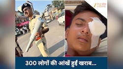 वायरल कार्बाइड गन कैसे बनी काल! फोड़ दी बच्चों की आंख; जुगाड़ी बम से हो जाएं सावधान