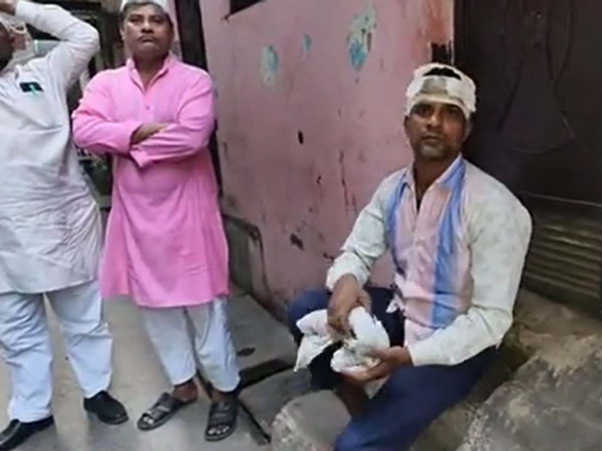 दिल्ली के गोकुलपुरी में मुस्लिम डिलीवरी बॉय से नाम पूछकर किया गया हमला; सर में गंभीर चोट दिल्ली के गोकुलपुरी में मुस्लिम डिलीवरी बॉय से नाम पूछकर किया गया हमला; सर में गंभीर चोट