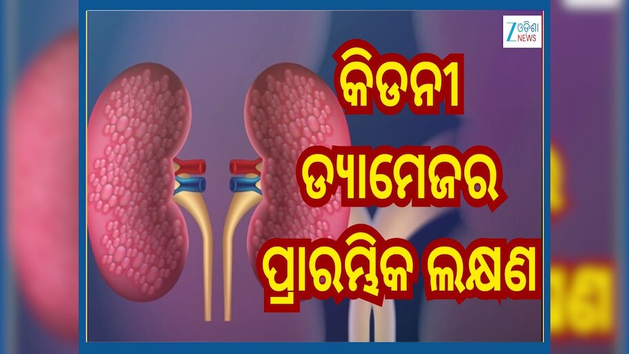 First Sign Of Kidney Damage: କିଡନୀ ଡ୍ୟାମେଜ୍ ହେଲେ ପ୍ରଥମେ ଦେଖାଦିଏ ଏହି ଲକ୍ଷଣ...ଜାଣିରଖନ୍ତୁ