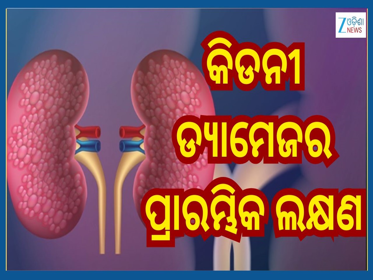 First Sign Of Kidney Damage: କିଡନୀ ଡ୍ୟାମେଜ୍ ହେଲେ ପ୍ରଥମେ ଦେଖାଦିଏ ଏହି ଲକ୍ଷଣ...ଜାଣିରଖନ୍ତୁ First Sign Of Kidney Damage: କିଡନୀ ଡ୍ୟାମେଜ୍ ହେଲେ ପ୍ରଥମେ ଦେଖାଦିଏ ଏହି ଲକ୍ଷଣ...ଜାଣିରଖନ୍ତୁ